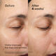 Eye and Lip Contour Regenerating Cream, 